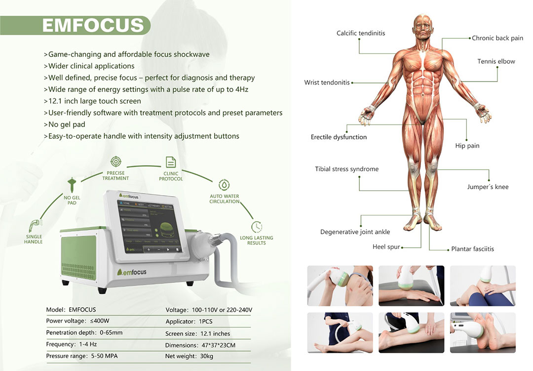 shockwave therapy