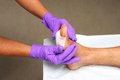 Caring for a Cut on the Bottom of the Foot